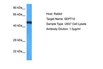 SEPT10 Rabbit Polyclonal Antibody