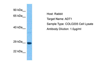 SLC25A4 Rabbit Polyclonal Antibody