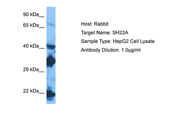SH2D2A Rabbit Polyclonal Antibody