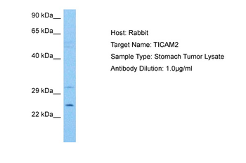 TMED7-TICAM2 Rabbit Polyclonal Antibody
