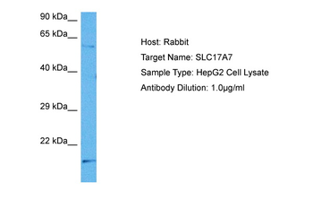 SLC17A7 Rabbit Polyclonal Antibody