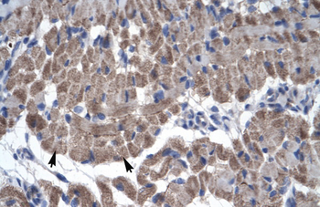 GAS7 Rabbit Polyclonal Antibody