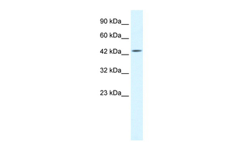 IKBKG Rabbit Polyclonal Antibody
