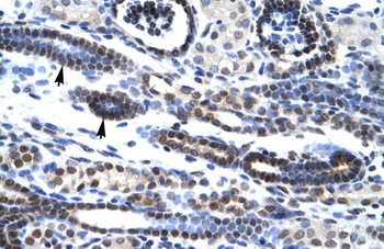 HES7 Rabbit Polyclonal Antibody