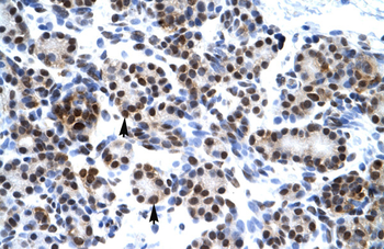 HES7 Rabbit Polyclonal Antibody