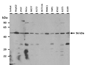 GLIS2 Rabbit Polyclonal Antibody
