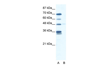 GLIS2 Rabbit Polyclonal Antibody