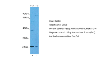 GLIS2 Rabbit Polyclonal Antibody