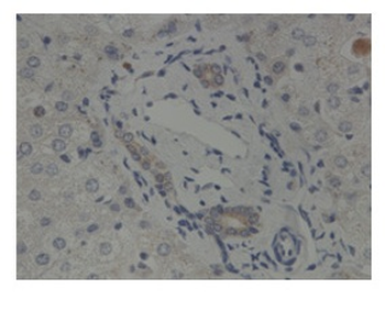 GLIS2 Rabbit Polyclonal Antibody