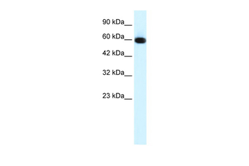 GLIS2 Rabbit Polyclonal Antibody