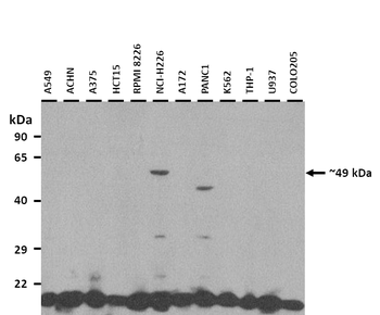 TEAD2 Rabbit Polyclonal Antibody
