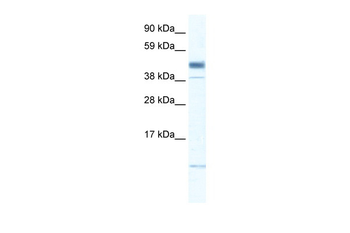 ZMAT1 Rabbit Polyclonal Antibody