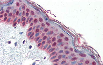 TCF7L1 Rabbit Polyclonal Antibody