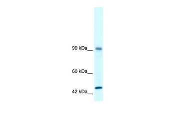 RBM10 Rabbit Polyclonal Antibody