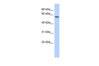 ELL Rabbit Polyclonal Antibody