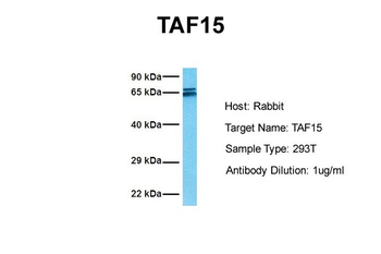 TAF15 Rabbit Polyclonal Antibody