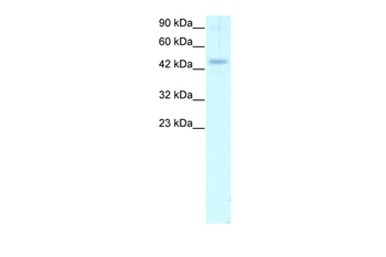 CALR Rabbit Polyclonal Antibody