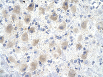 YEATS4 Rabbit Polyclonal Antibody