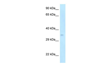 Cdk5r1 Rabbit Polyclonal Antibody
