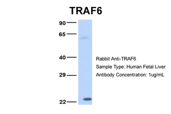 TRAF6 Rabbit Polyclonal Antibody