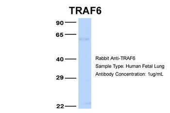 TRAF6 Rabbit Polyclonal Antibody