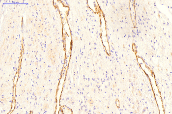 ERBB3 Rabbit Polyclonal Antibody