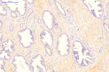 ERBB3 Rabbit Polyclonal Antibody