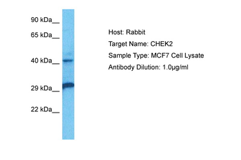 CHEK2 Rabbit Polyclonal Antibody