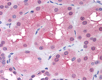 TP53 Rabbit Polyclonal Antibody