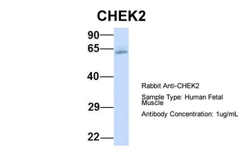 CHEK2 Rabbit Polyclonal Antibody