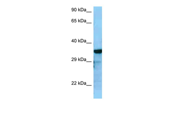 RGS4 Rabbit Polyclonal Antibody