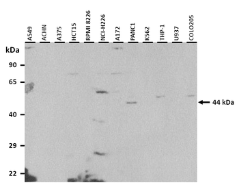 TP53 Rabbit Polyclonal Antibody