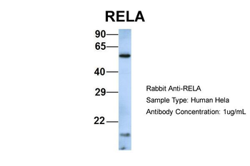 RELA Rabbit Polyclonal Antibody