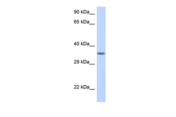 CRK Rabbit Polyclonal Antibody