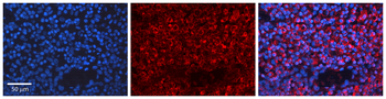 BRCA1 Rabbit Polyclonal Antibody