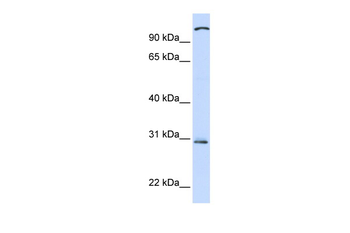 TLR2 Rabbit Polyclonal Antibody