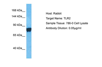 TLR2 Rabbit Polyclonal Antibody