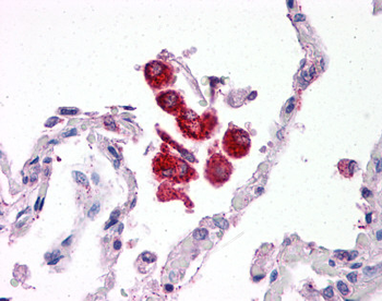 TLR2 Rabbit Polyclonal Antibody