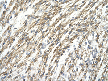 HIF1A Rabbit Polyclonal Antibody