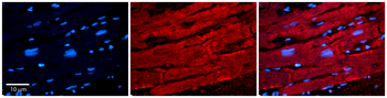 ID1 Rabbit Polyclonal Antibody