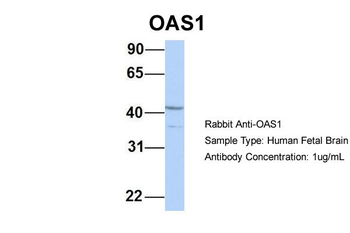 OAS1 Rabbit Polyclonal Antibody