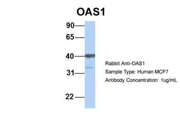 OAS1 Rabbit Polyclonal Antibody