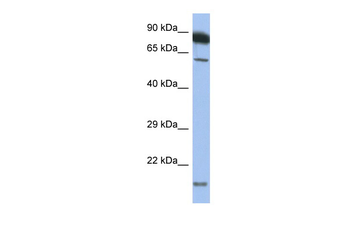 TNFRSF10A Rabbit Polyclonal Antibody