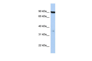 FAS Rabbit Polyclonal Antibody