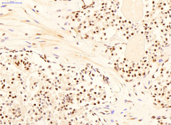 YWHAE Rabbit Polyclonal Antibody