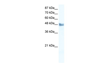 MAP3K8 Rabbit Polyclonal Antibody