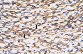 CCL7 Rabbit Polyclonal Antibody