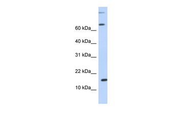 CCL7 Rabbit Polyclonal Antibody