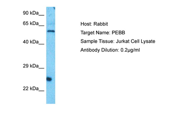 CBFB Rabbit Polyclonal Antibody