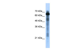 FOXO1 Rabbit Polyclonal Antibody